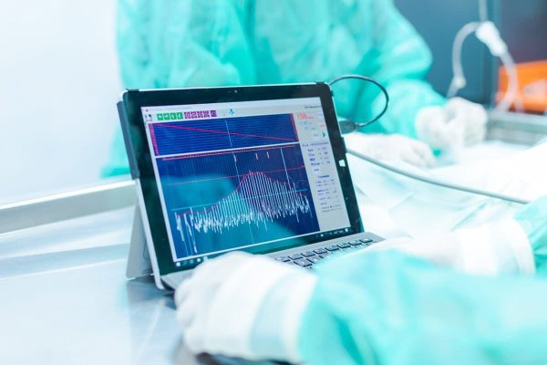 Pantalla ecocardiografía Hospital Veterinario Riera Alta Barcelona